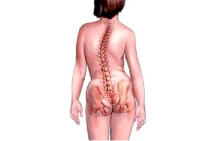 Vzroki za razvoj cervikalne osteohondroze