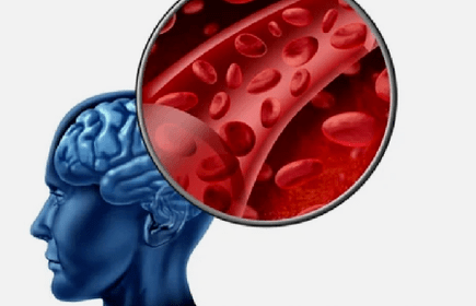 simptomi osteohondroze vratne hrbtenice