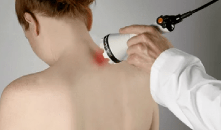 zdravljenje cervikalne osteohondroze z uporabo fizioterapevtskih metod