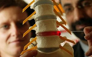 Simptomi in zdravljenje osteohondroze torakalne hrbtenice