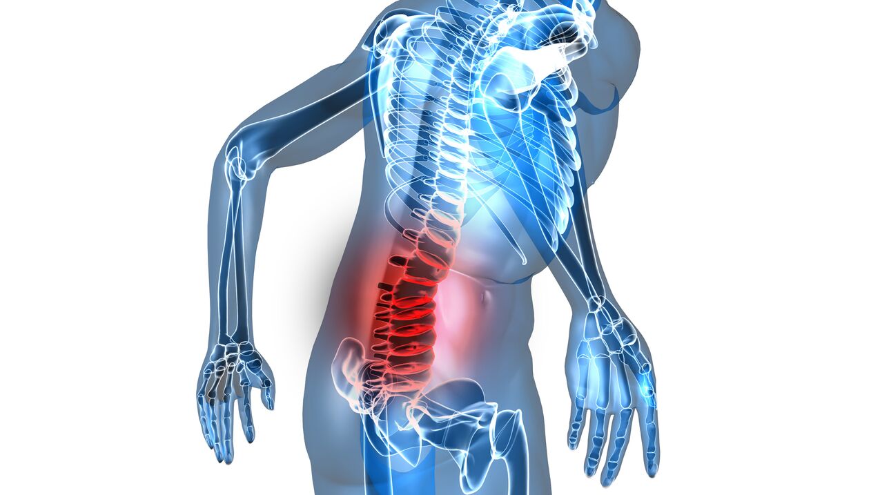 osteohondroza ledvene hrbtenice